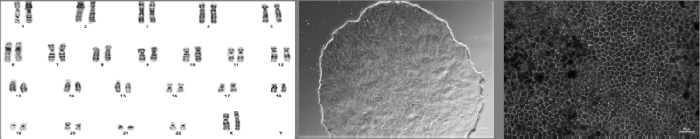 Figure ure 4: Gene expression changes in hiPSC-RPE treated with MEK inhibition. A) Selumetinib alters expression of genes related to fluid transport primarily in cells from an NF1 patient without MEKAR. *; significant difference between Untreated and Treated in NF1 without MEKAR. †; significant difference between Untreated and Treated in NF1 with MEKAR. B) The same data rearranged to highlight the expression of genes regulating fluid transport and cell volume regulation are higher in cells from an NF1 patient without MEKAR compared to cells from an NF1 patient with MEKAR. *; significant difference between NF1 with MEKAR and NF1 without MEKAR in Untreated.